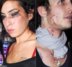 Amy Winehouse & Blake